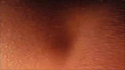 Emmi-Hill - Arschloch ganz nah, das ist doch klar