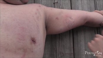 MissFlora - Kleine böse bisse