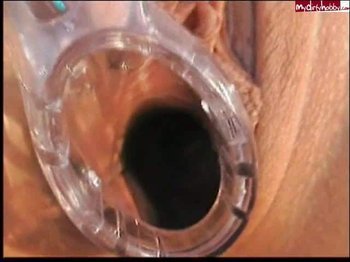 WixxVorlage - Pink Caddilac Teil 2Spekulum