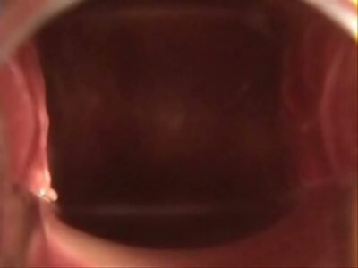 Born4Sex - Mit dem Spekulum